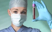 Xét nghiệm máu xác định tái phát ung thư vú