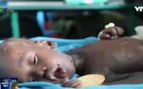 Nam Sudan tuyên bố nạn đói ở nhiều vùng