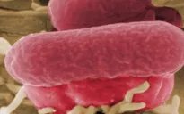 Mỹ thu hồi bơ đậu nành nhiễm khuẩn E.coli