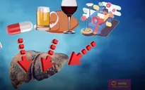 Thói quen xấu đang "giết" lá gan của bạn
