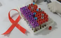 Lây nhiễm HIV/AIDS qua đường tình dục chỉ còn 5% nếu tuân thủ điều này