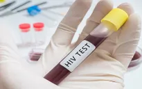 50.000 người có thể nhiễm HIV mà không biết