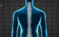 Liệu pháp gây tê màng cứng giúp người bị liệt đi lại được