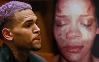 Chris Brown bị ám ảnh suốt đời về Rihanna