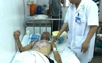 Đi ăn cỗ cưới, 8 người bị bỏng nặng tại Cần Thơ