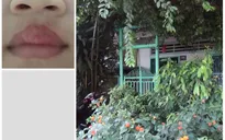 Đồng Tháp: Ngừng hoạt động nhà trẻ bạo hành trẻ bằng ớt