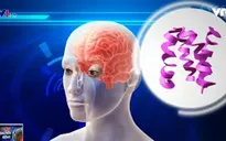 Ô nhiễm không khí làm tăng nguy cơ mắc Alzheimer