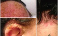 Chỉ vì nhuộm tóc, người phụ nữ này suýt mất mạng