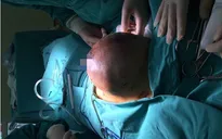 Phẫu thuật thành công ca mổ loại bỏ khối u tuyến vú khổng lồ
