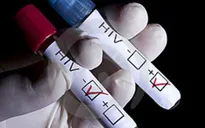 Công nghệ mới giúp phát hiện HIV chỉ sau 1 tuần phơi nhiễm