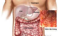 Những món ăn đưa con người tới gần hơn với ung thư đại trực tràng