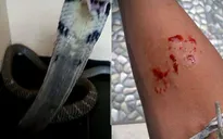 Bị rắn hổ mang cắn, thiếu niên chụp ảnh “khoe” lên mạng xã hội rồi tử vong