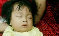 Thương bé 9 tháng tuổi bụ bẫm mắc bệnh ung thư máu