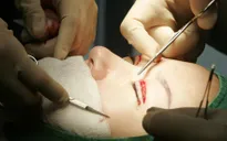 Phẫu thuật thẩm mỹ thay đổi cuộc sống con người như thế nào?