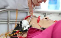 Nhiều người bị méo miệng do thời tiết lạnh