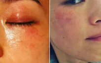 Thư Kỳ tuyên bố muốn tạm ngừng công việc diễn xuất