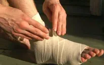 9 bước sơ cứu vết cắt và vết cào xước