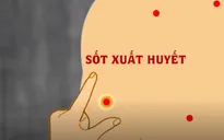 Dấu hiệu mắc sốt xuất huyết bạn có thể tự nhận biết
