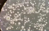 Video sữa mẹ dưới kính hiển vi thu hút hàng triệu lượt xem