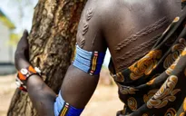 Nhức nhối nạn tấn công tình dục ở Nam Sudan