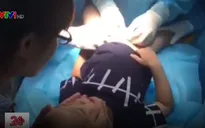 Hoang mang hành trình chữa bệnh cho hàng loạt trẻ mắc sùi mào gà