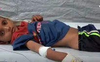 Báo động dịch tả nghiêm trọng nhất lịch sử tại Yemen