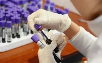 Lùi thời hạn liên thông kết quả xét nghiệm 1 tháng