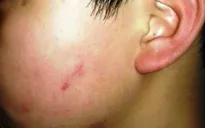 Chủ tịch Hà Nội yêu cầu kiểm tra vụ việc cô giáo cho học sinh tát bạn