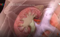 Chế độ dinh dưỡng cho bệnh nhân viêm cầu thận cấp