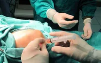 Bước tiến mới trong điều trị thoái hóa khớp