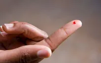 Phương pháp mới chẩn đoán sớm ung thư tuyến tụy