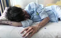 Nhiều người lớn và trẻ nhỏ mắc bệnh thủy đậu