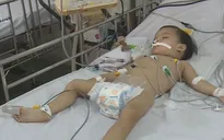 Nhiều trẻ mắc bệnh vì không tiêm vaccine đầy đủ