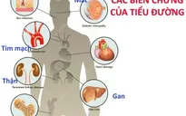 Việt Nam thuộc top các nước có tỷ lệ gia tăng bệnh tiểu đường cao nhất thế giới