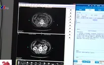 Trung Quốc sử dụng trí thông minh nhân tạo vào công tác chữa bệnh