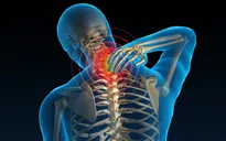 Đau đầu, chóng mặt, mất ngủ - Triệu chứng của thoái hóa đốt sống cổ