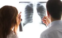 Số người mắc ung thư phổi tăng tại Việt Nam