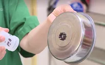 Nuốt nam châm ở đồ chơi gây nguy hiểm tính mạng trẻ nhỏ