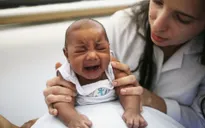 Tỷ lệ trẻ sơ sinh mắc dị tật bẩm sinh do virus Zika cao tại Mỹ