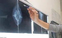 Mỗi ngày, Việt Nam có khoảng 260 người chết vì ung thư