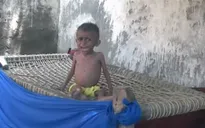 Phó Tổng Thư ký LHQ cảnh báo Yemen sắp sụp đổ toàn diện