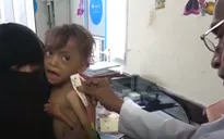 Liên Hợp Quốc cảnh báo về những thảm họa khủng khiếp tại Yemen