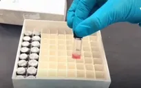 Que thử phát hiện sớm virus Zika