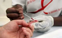 Ngày càng ít người trẻ tại Mỹ xét nghiệm HIV/AIDS