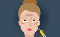 Những điều bạn chưa biết về làm đẹp bằng “mặt nạ ma cà rồng“