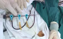Thay máu kịp thời, cứu sống bệnh nhi 3 ngày tuổi bị vàng da