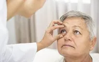 Nhiều bệnh về mắt mà người cao tuổi phải đối mặt