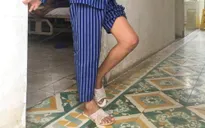 Bé gái 12 tuổi bị cứng khớp gối do bó thuốc nam