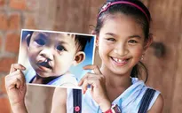 Khám sàng lọc và phẫu thuật cho người bị dị tật khe hở môi - vòm miệng tại TP.HCM