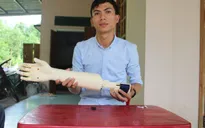 Sinh viên chế tạo tay robot giá rẻ cho người khuyết tật